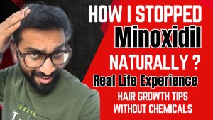 How I Stopped Minoxidil Naturally & Hair Growth Tips Without Chemicals